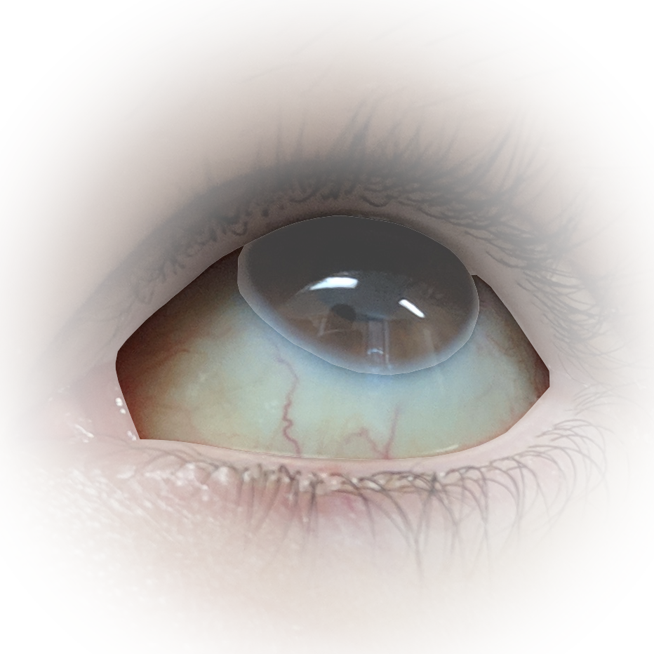 Sclera